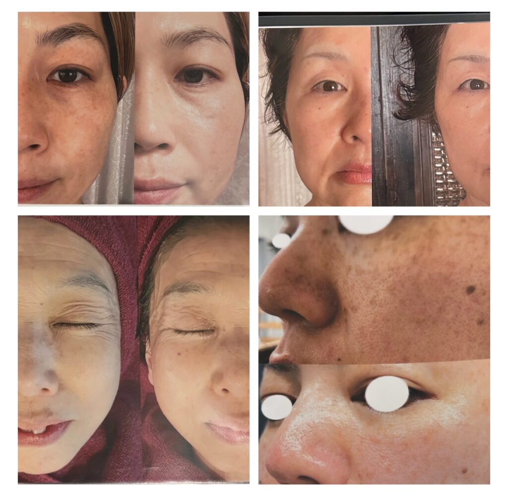 美容サロンとコラボ企画した画像